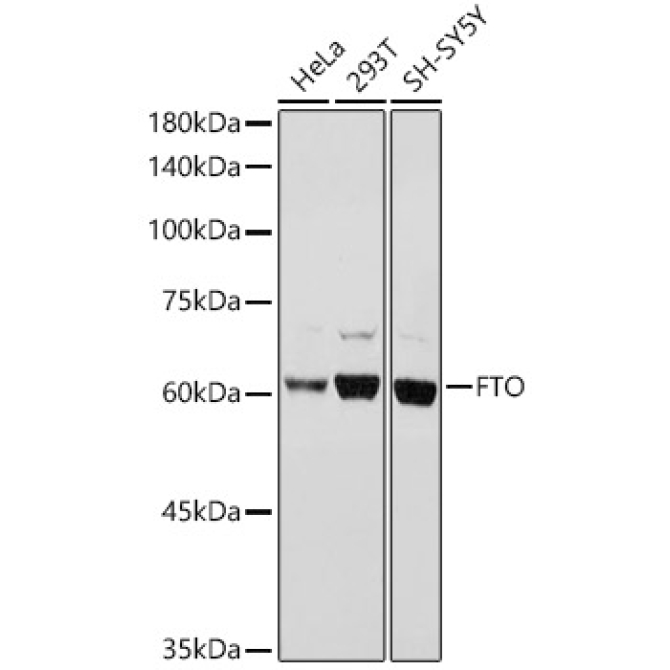FTO Rabbit Polyclonal Antibody