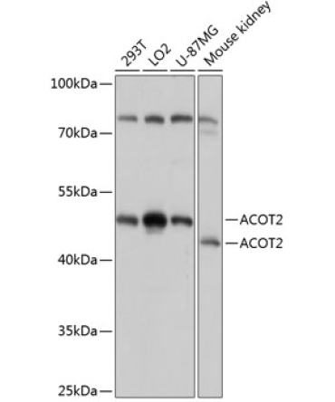 ACOT2 Rabbit Polyclonal Antibody