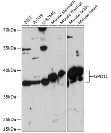 GPD1L Rabbit Polyclonal Antibody