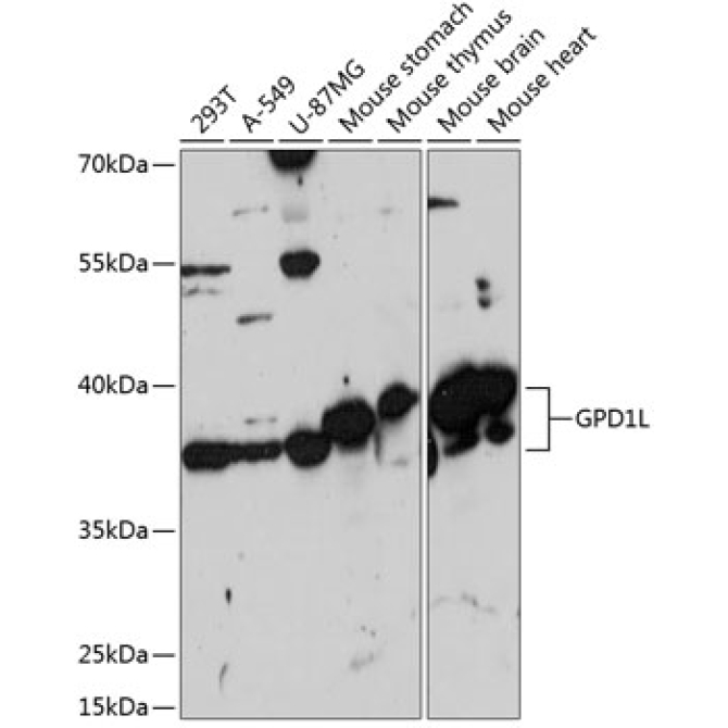 GPD1L Rabbit Polyclonal Antibody