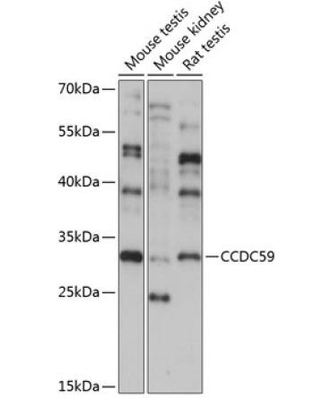 CCDC59 Rabbit Polyclonal Antibody