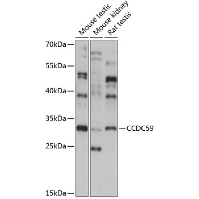 CCDC59 Rabbit Polyclonal Antibody