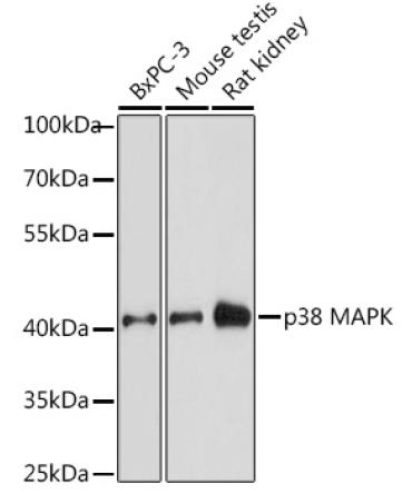 p38 MAPK Rabbit Polyclonal Antibody