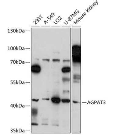 AGPAT3 Rabbit Polyclonal Antibody