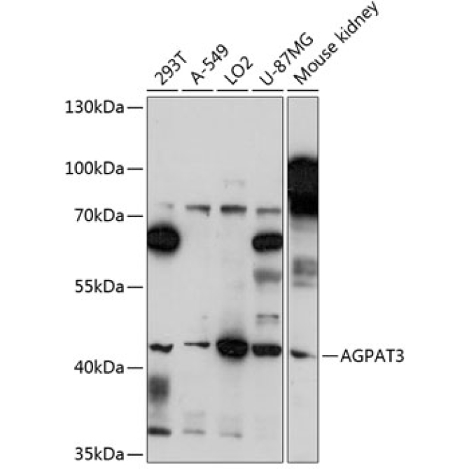 AGPAT3 Rabbit Polyclonal Antibody