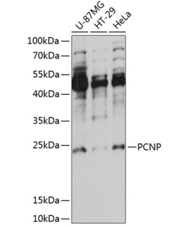 PCNP Rabbit Polyclonal Antibody