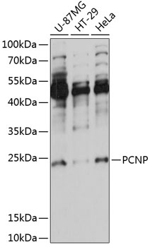 PCNP Rabbit Polyclonal Antibody