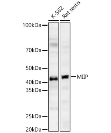 MIIP Rabbit Polyclonal Antibody
