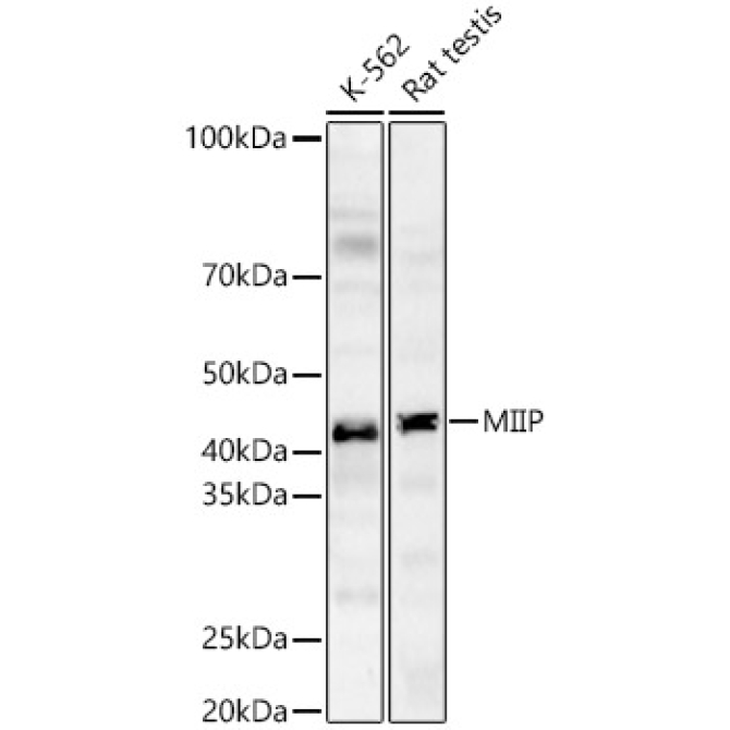 MIIP Rabbit Polyclonal Antibody