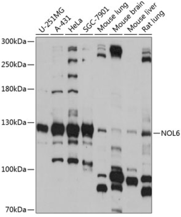 NOL6 Rabbit Polyclonal Antibody