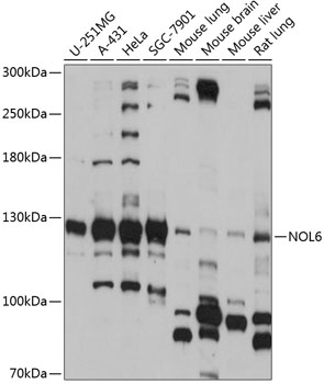 NOL6 Rabbit Polyclonal Antibody