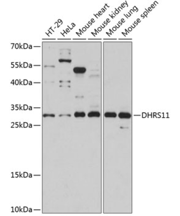 DHRS11 Rabbit Polyclonal Antibody