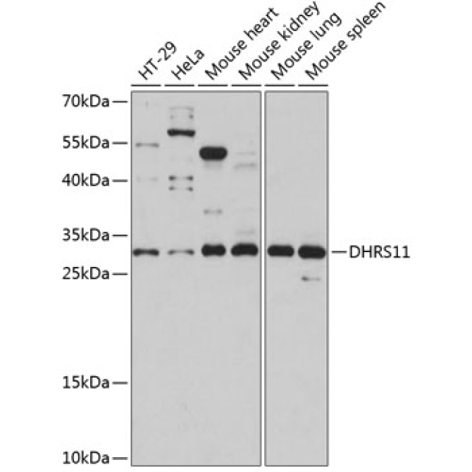DHRS11 Rabbit Polyclonal Antibody