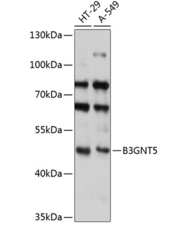 B3GNT5 Rabbit Polyclonal Antibody