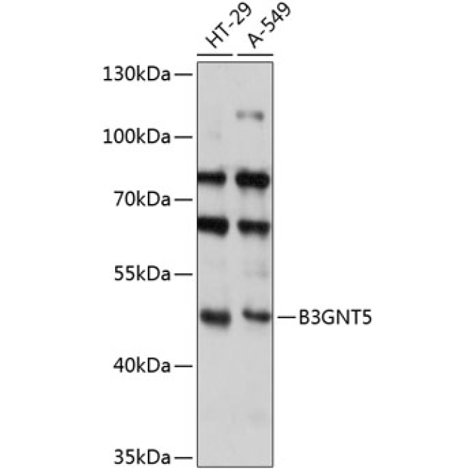 B3GNT5 Rabbit Polyclonal Antibody
