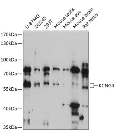 KCNG4 Rabbit Polyclonal Antibody