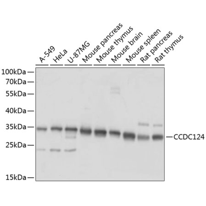 CCDC124 Rabbit Polyclonal Antibody