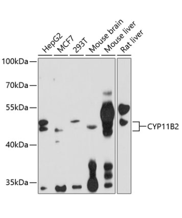CYP11B2 Rabbit Polyclonal Antibody