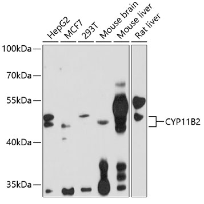 CYP11B2 Rabbit Polyclonal Antibody