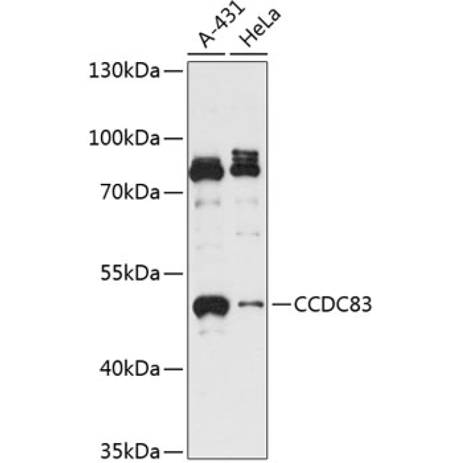 CCDC83 Rabbit Polyclonal Antibody