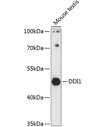 DDI1 Rabbit Polyclonal Antibody