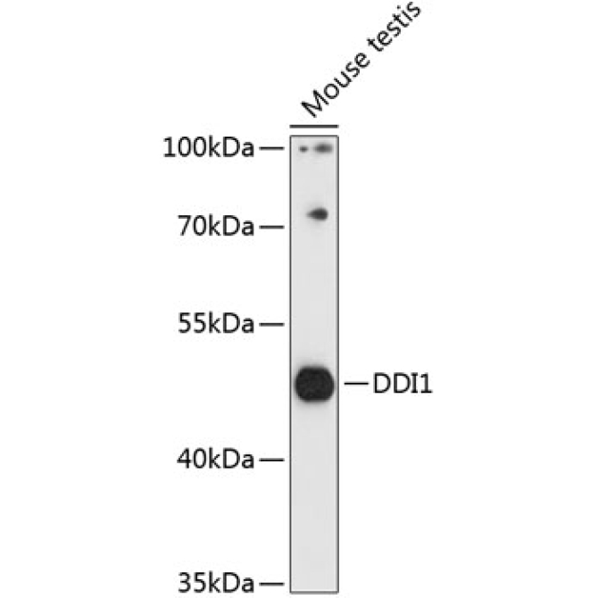 DDI1 Rabbit Polyclonal Antibody