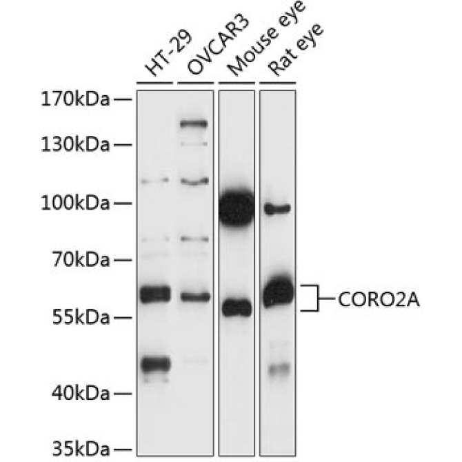 CORO2A Rabbit Polyclonal Antibody