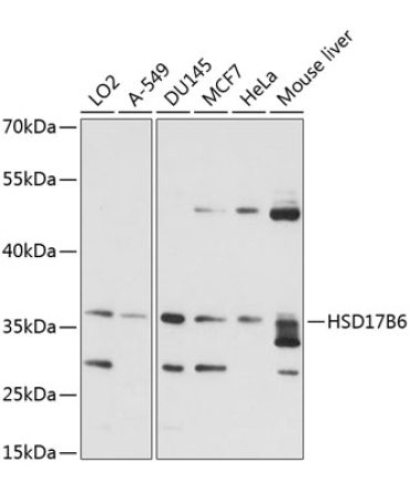 HSD17B6 Rabbit Polyclonal Antibody
