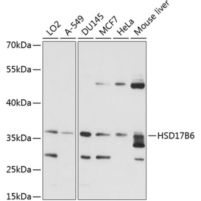 HSD17B6 Rabbit Polyclonal Antibody