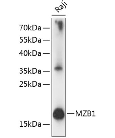 MZB1 Rabbit Polyclonal Antibody