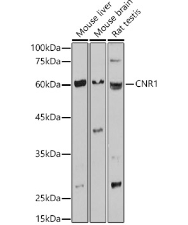 CNR1 Rabbit Polyclonal Antibody
