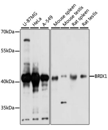 BRIX1 Rabbit Polyclonal Antibody