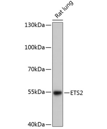 ETS2 Rabbit Polyclonal Antibody