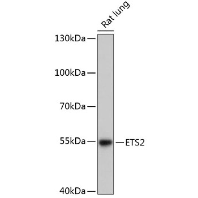 ETS2 Rabbit Polyclonal Antibody