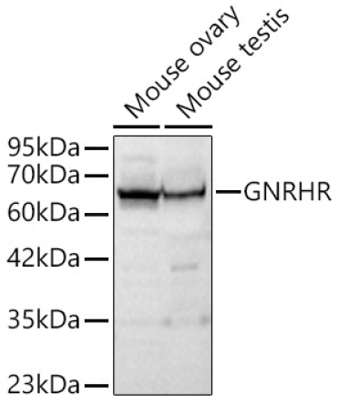 GNRHR Rabbit Polyclonal Antibody