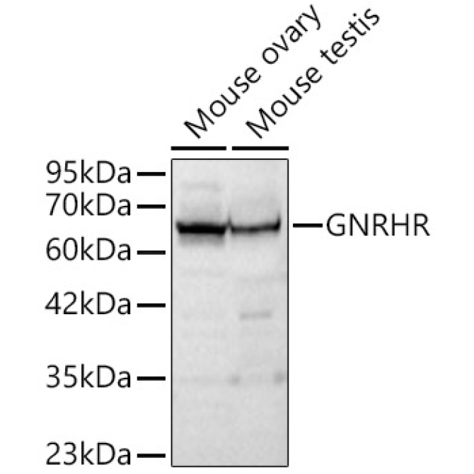 GNRHR Rabbit Polyclonal Antibody
