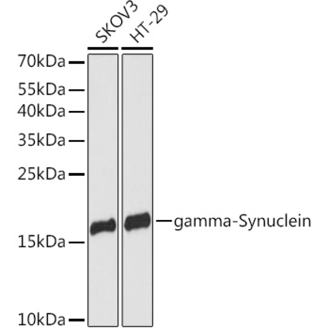 gamma-Synuclein Rabbit Polyclonal Antibody