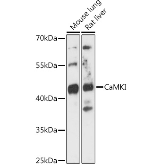 CaMKI Rabbit Polyclonal Antibody