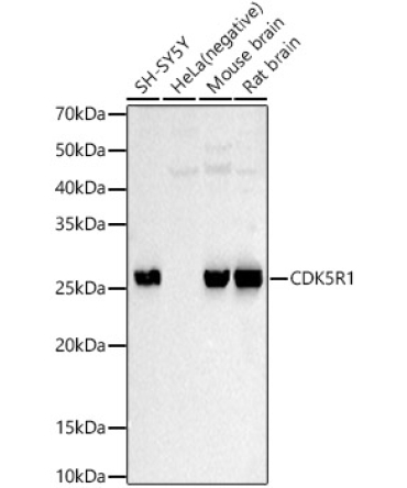 CDK5R1 Rabbit Polyclonal Antibody