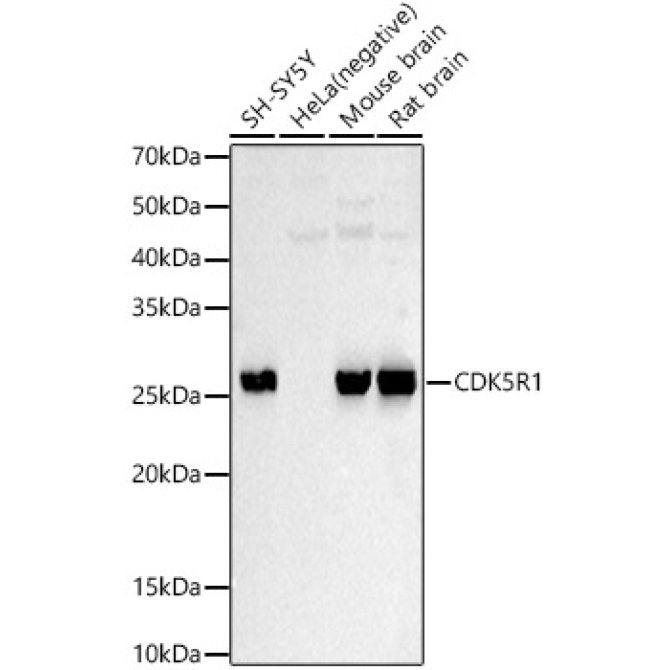 CDK5R1 Rabbit Polyclonal Antibody