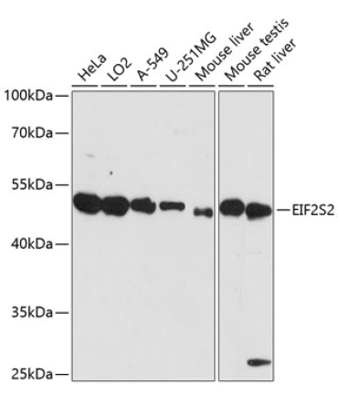 EIF2S2 Rabbit Polyclonal Antibody
