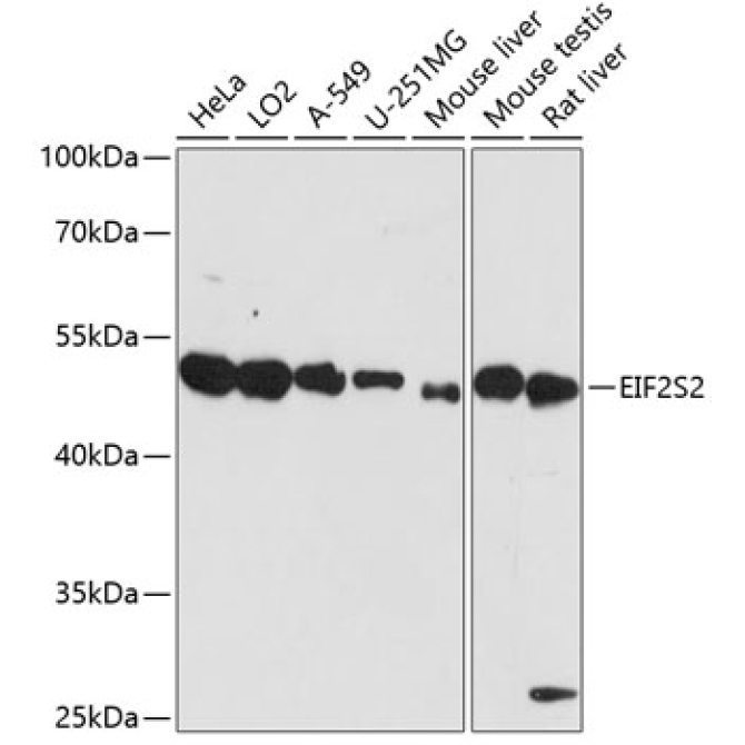 EIF2S2 Rabbit Polyclonal Antibody