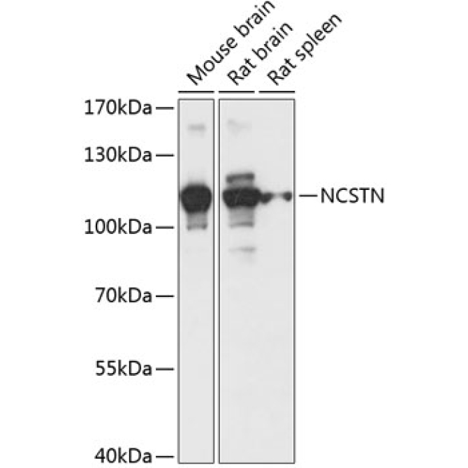 NCSTN Rabbit Polyclonal Antibody