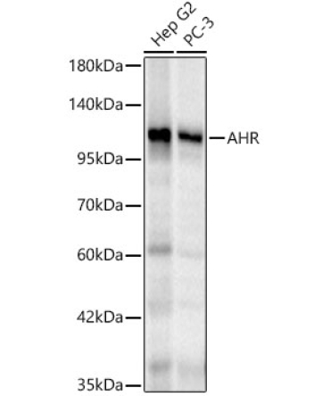 AHR Rabbit Polyclonal Antibody
