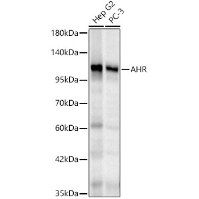 AHR Rabbit Polyclonal Antibody