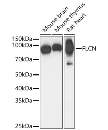 FLCN Rabbit Polyclonal Antibody