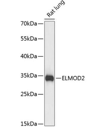 ELMOD2 Rabbit Polyclonal Antibody