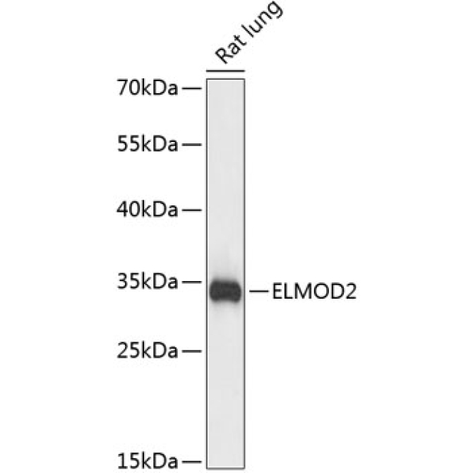 ELMOD2 Rabbit Polyclonal Antibody