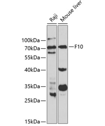 F10 Rabbit Polyclonal Antibody