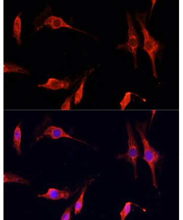 DNASE1 Rabbit Polyclonal Antibody